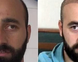 ناد تركي يطرد لاعبه لانه زرع شعراً دون إذن