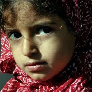 “جانا”.. طفلة يمنية فقدت ابتسامتها في اليمن وأعادتها مستشفى بتركيا‎