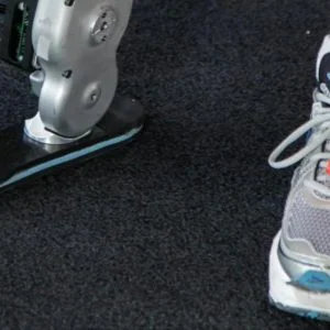 خبير تركي يصنع أطرافاً لتأهيل معاقي الحرب في اليمن