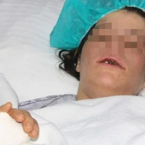 مهندس سوري يعتدي على زوجته بوحشية في مدينة كليس التركية