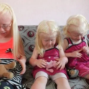 الشمس تسلب حرية اللعب من ثلاث “ملائكة بيضاء” جنوبي تركيا