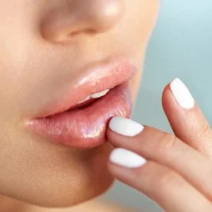 هذا ما يخبرك به لون شفتيك عن صحتك!