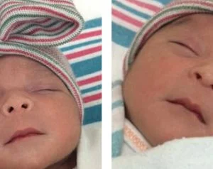 توأمان ولكن وُلدا في يومين وشهرين وعامين مختلفين!