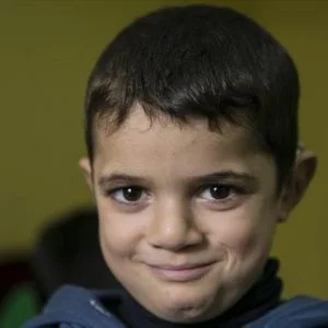 طفل سوري أفقدته طائرات النظام السمع فاستعاده في تركيا