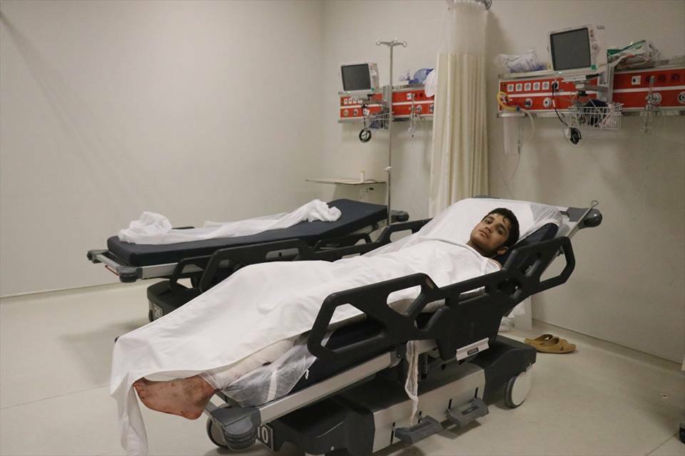 شاهد بالصور.. جريح من "ب ي د" في مستشفى هاتاي التركي 1