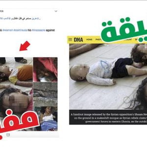 أنصار “ب ي د” الإهابي ينسبون صور أطفال سوريين استهدفهم قصف النظام لـ”غصن الزيتون”