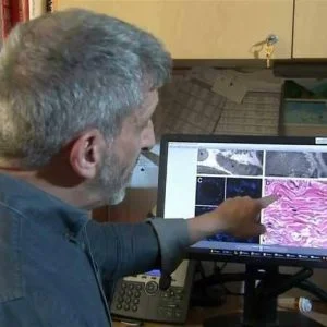 فيديو.. اكتشاف عضو جديد في جسم الإنسان.. وهو الأكبر