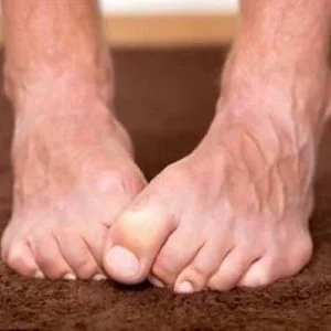 هذا ما تخبره قدماك عن صحتك!