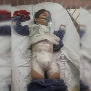 طفل سوري يفقد عضوه الذكري خلال ‘تطهيره’ !
