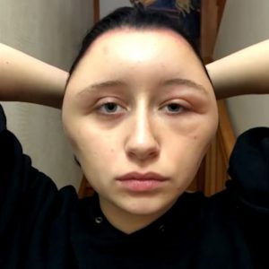 شاهد.. بسبب صبغة الشعر .. وجه فتاة جميلة يتحول إلى كرة 5