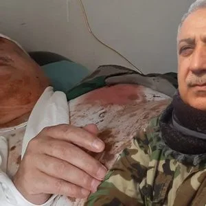 إصابة الإرهابي “معراج أورال” بجروح بليغة