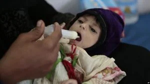 أكثرهم عرب.. 16 مليون طفل يعانون من سوء التغذية بالشرق الأوسط وشمال أفريقيا