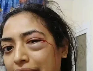 “أغيثوني قبل فوات الأوان”.. “شاهد” ما فعله “عديم مروءة” مع زوجته في الإمارات يفجر غضبا واسعا بمواقع التواصل!