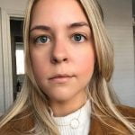 شاهد ماذا فعل "ورم دماغي" بهذه الفتاة 3