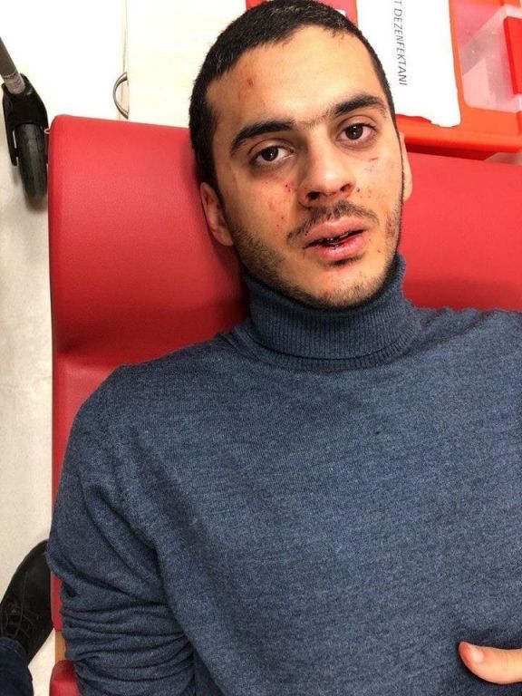 شاب مصري يتعرض للضرب في اسطنبول.. التفاصيل كاملة 5