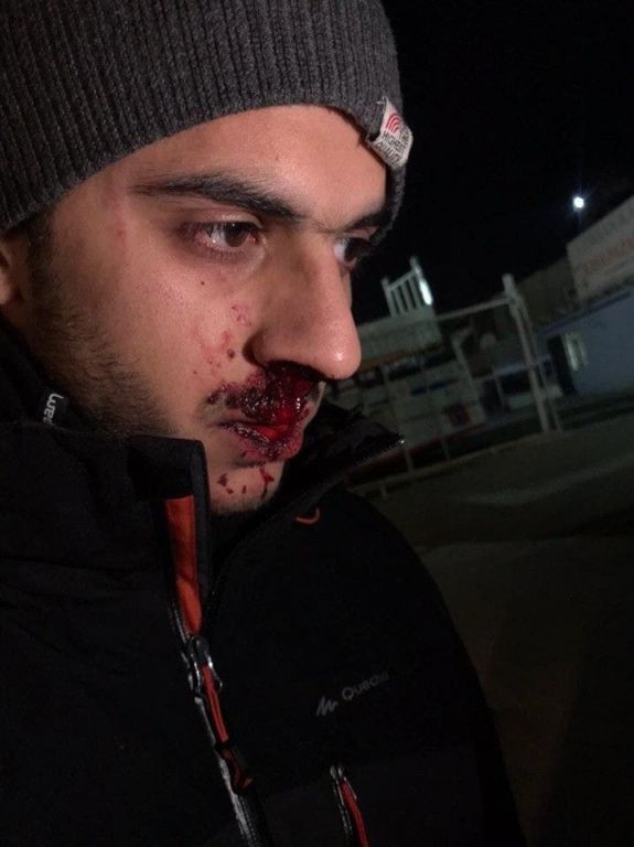 شاب مصري يتعرض للضرب في اسطنبول.. التفاصيل كاملة 3