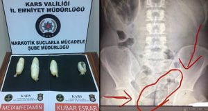بالصور| محاولة "جنونية" من مقيمين اثنين لتهريب "المخدرات" في تركيا 1