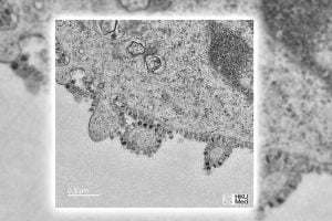 أول صورة لـ"فيروس كورونا" في الصين 1