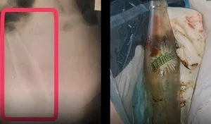 لا يُصدق.. “شاهد” ما تم استخراجه من مؤخرة سوري عائد من لبنان يصدم النشطاء ويثير جدلاً واسعاً