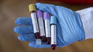 موقع استرالي يكشف عن “علاج” فعال لفيروس كورونا