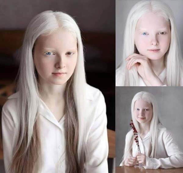 طفلة شيشانية تثير الجدل بجمالها الاستثنائي.. حقيقة أم فوتوشوب؟ 1