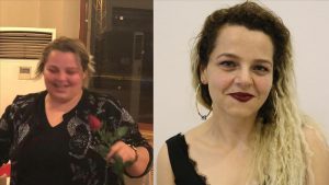 امرأة تركية تخسر 70 كغ من وزنها خلال 11 شهرا