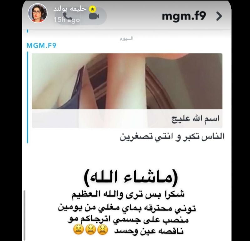 حليمة بولند تتعرض لحروق شديدة بعد وقوع ماء مغلي على جسدها 1