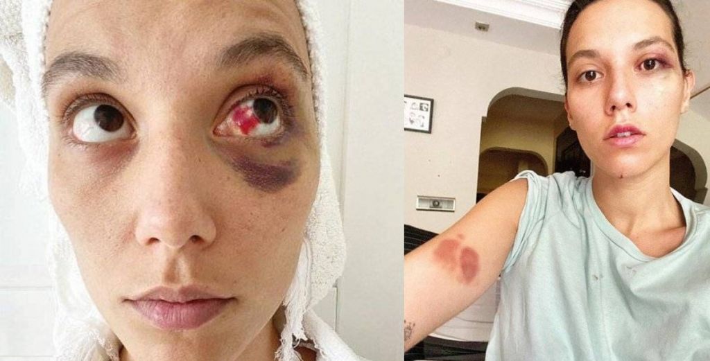 أوزان غوفين يؤكد اعتداء حبيبته عليه.. وصفها بألفاظ نابية أمام الجميع (صور) 2 أوزان غوفين يؤكد اعتداء حبيبته عليه.. وصفها بألفاظ نابية أمام الجميع (صور) 1