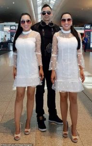 التوأم الأكثر تطابقًا في العالم تعتزمان الإنجاب من صديق مشترك.. (صور) 1