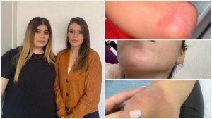 فرنسا.. فتاتان تركيتان تتعرضان للضرب من الشرطة