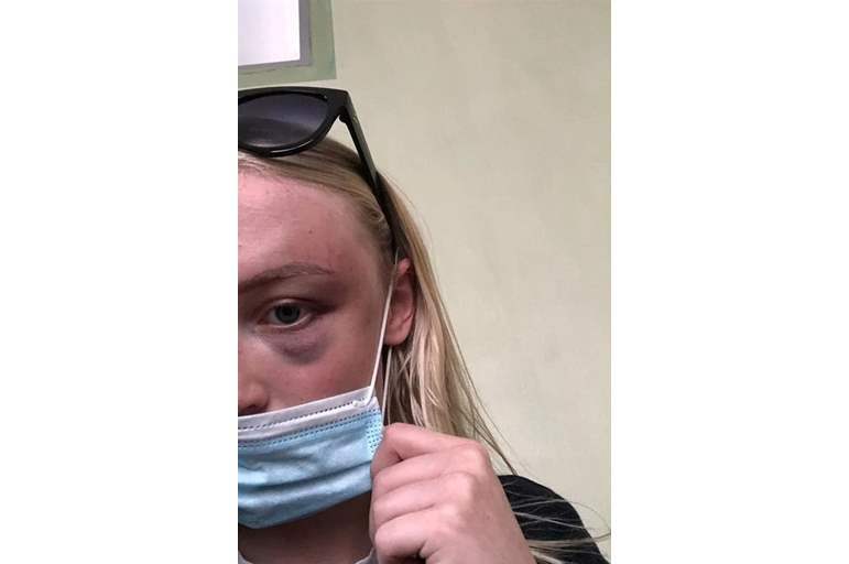 شاهد.. علقة مورت لعارضة أزياء حسناء من خطيبها السابق 23