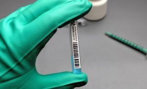 نتائج جديدة حول دراسات اللقاح المرتقب