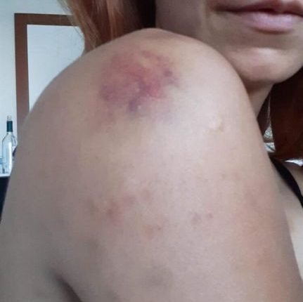 الطبيبة البيطرية التي تعرضت للتعذيب