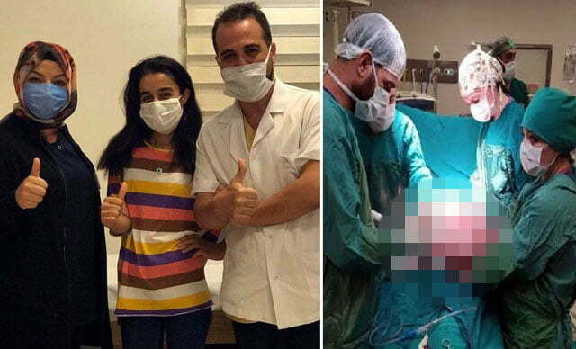 الشابة شيلان أثناء العملية (يمين) وبعدها