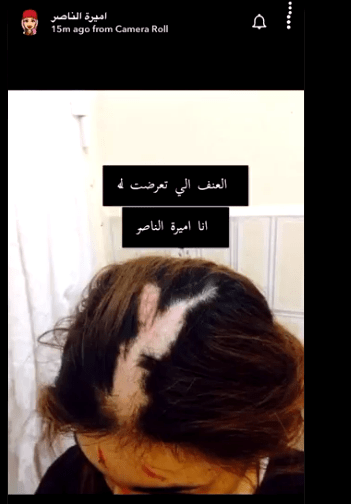 الناصر حادث اميره بالفيديو
