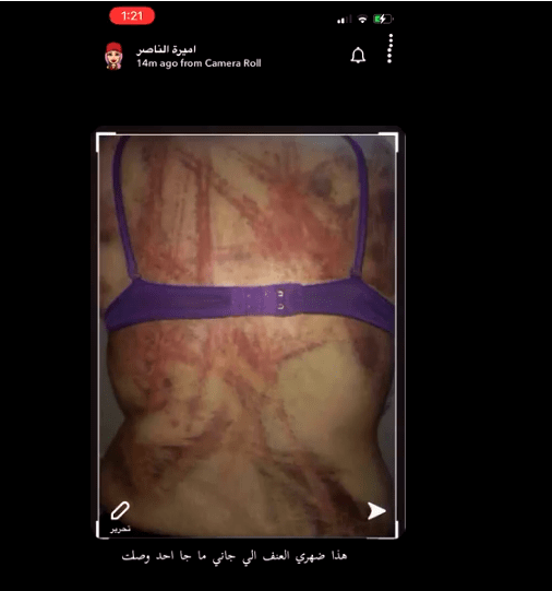 أميرة الناصر تنشر صور تعرضها للضرب والعنف الجسدي.. وتعود للحجاب 5