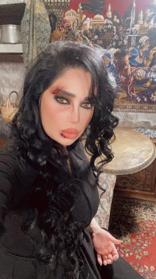 رنا الأبيض تصدم الجمهور بتشوّه ملامحها.. ما القصة؟ (صور) 1