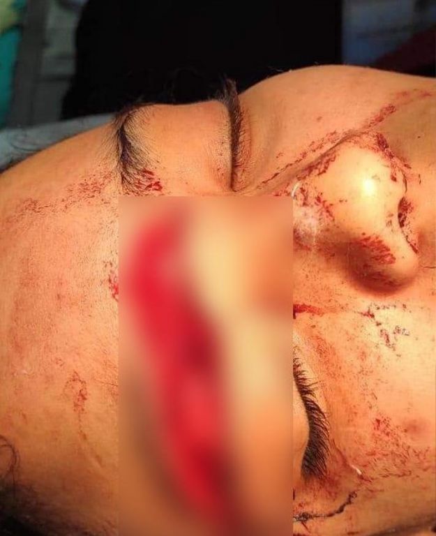 بالصور.. شاب مصري يشق جمجمة فتاة بالساطور بعدما رفضت الزواج منه 9