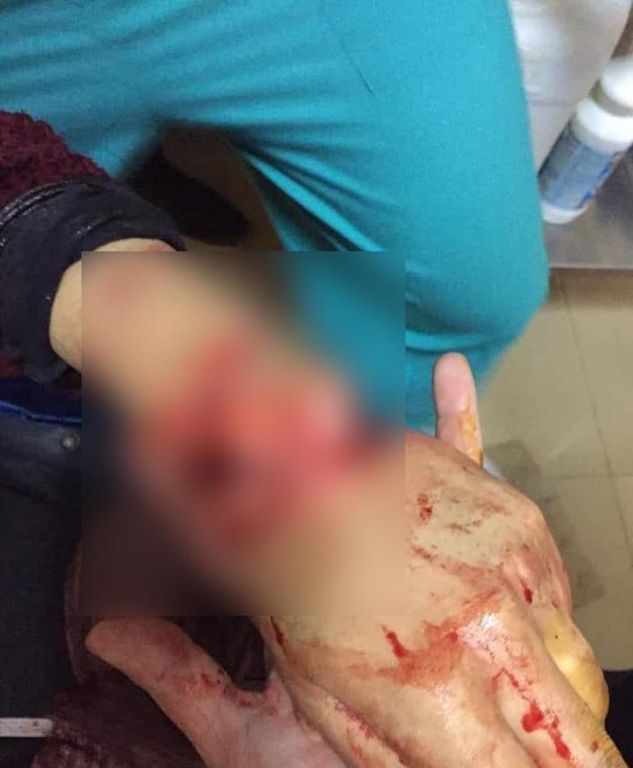 بالصور.. شاب مصري يشق جمجمة فتاة بالساطور بعدما رفضت الزواج منه 11