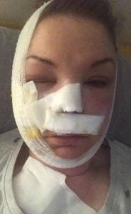 امرأة وضعت “بيضة” داخل الميكروويف.. فحدثت الكارثة "صور" 1