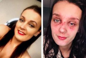 امرأة وضعت “بيضة” داخل الميكروويف.. فحدثت الكارثة "صور" 3