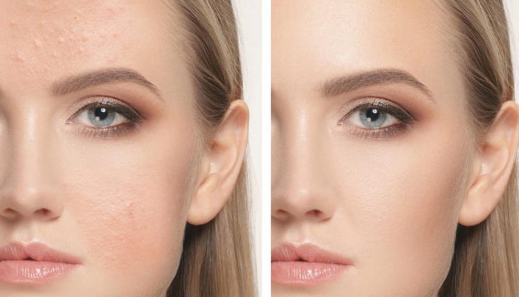 علاج التهابات الجلد بمكونات منزلية بسيطة