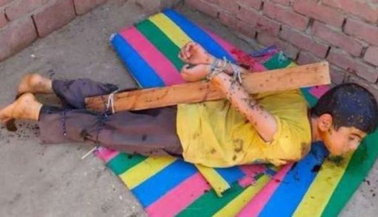 مصري يعذب ابنه بالعسل الأسود