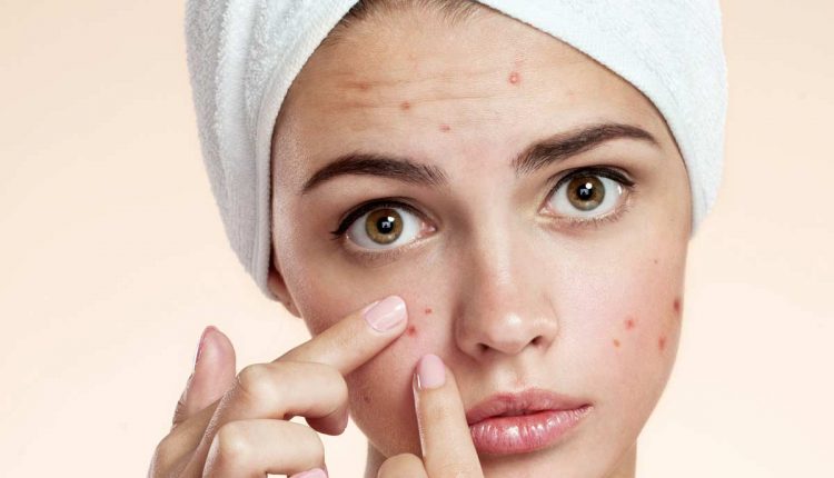 طرق علاج حبوب الوجه