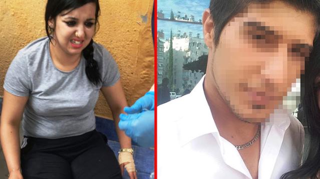 تركيا .. الغيرة تدفع رجل لإطلاق النار على زوجته 9