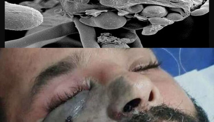 ما هو القاتل الأسود؟