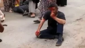 تركي يتعرض للضرب بسبب طفلة في بورصة (صورة)