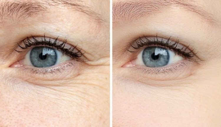 طرق طبيعية تخلصك من تجاعيد العين