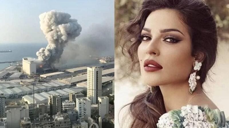 نادين نجيم تستذكر تجربتها الصعبة في انفجار مرفأ بيروت
