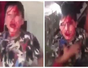 بالفيديو.. عراقي يعذب طفله بوحشية حتى سالت الدماء من وجهه ويجبره على ترديد عبارات بذيئة
